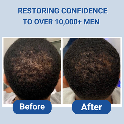 Hair Growth Roll-On Serum