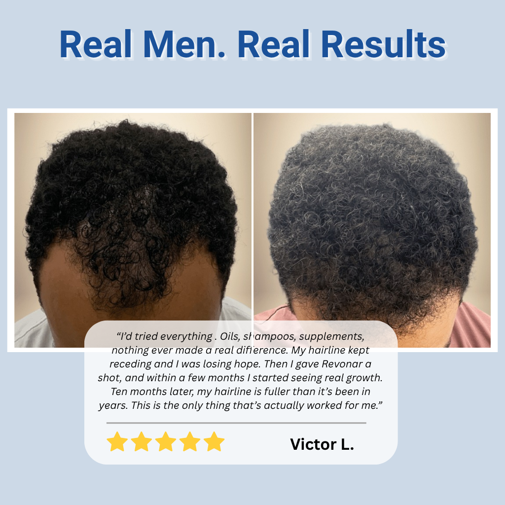 Hair Growth Roll-On Serum