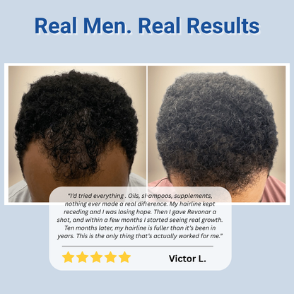 Hair Growth Roll-On Serum